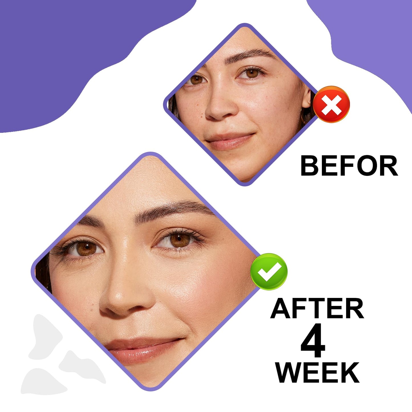 Retinol & Hyaluronic Acid Night Cream, Anti-Aging Face Moisturizer,Anti-Aging Retinol Face Cream for Women, Firms Skin to Fight Fine Lines, Wrinkles & Dark Spots, 1.7 oz