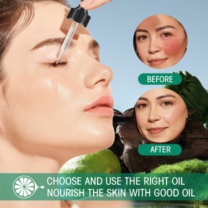 Bergamot Essential Oil for Skin - 100% Natural Bergamot Oil for Anti-Aging, Moisturizing, Wrinkle Reduction, & Skin Firming | Perfect Natural Skin Moisturizer (1 Fl Oz)