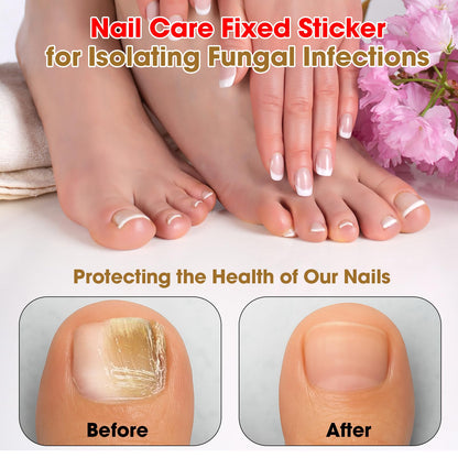 Multi Purpose Nail Repair Patch, 15 Nail Stickers, Used for nail Dust Prevention, Preventing Fungal Infections, and Maintaining Healthy nail Appearance