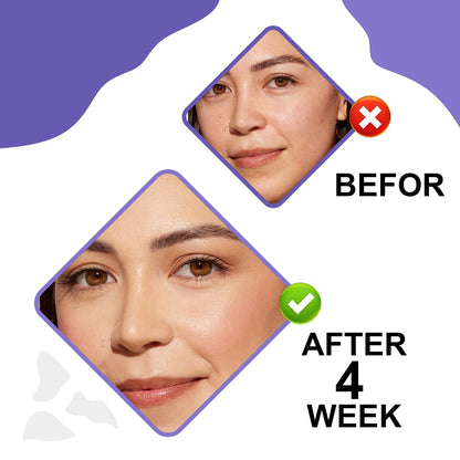 Retinol & Hyaluronic Acid Night Cream, Anti-Aging Face Moisturizer，Anti-Aging Retinol Face Cream for Women, Firms Skin to Fight Fine Lines, Wrinkles & Dark Spots, 1.7 oz
